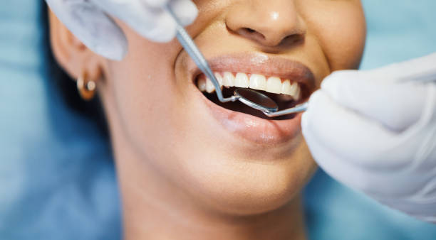 Best Emergency Treatment for Dental Infections or Abscesses in Lafayette, CA