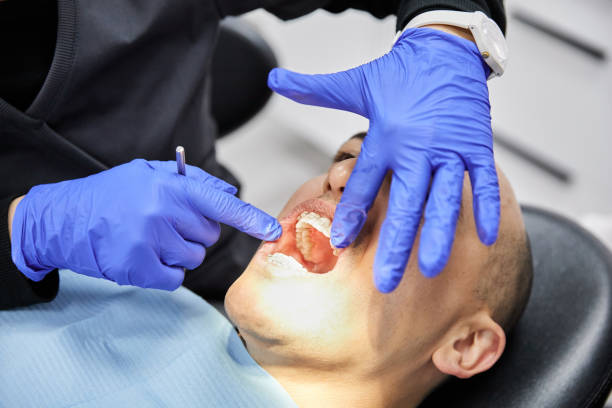 Best After-Hours Dental Trauma Care in Lafayette, CA
